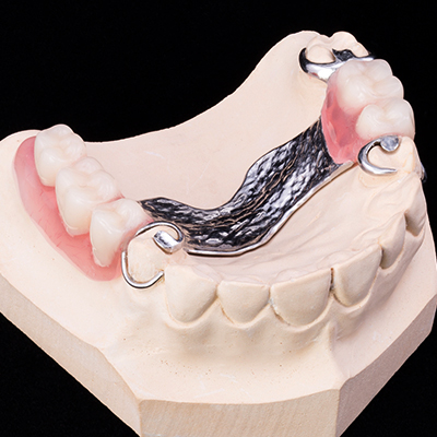 The model of the jaw with the inserted denture