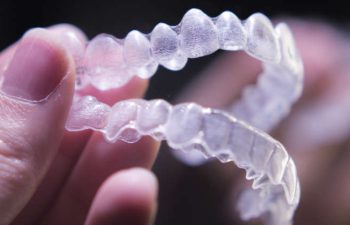 Dental Aligners