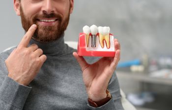 A man pointing at his perfect teeth holding a model of dental implant in the other hand.